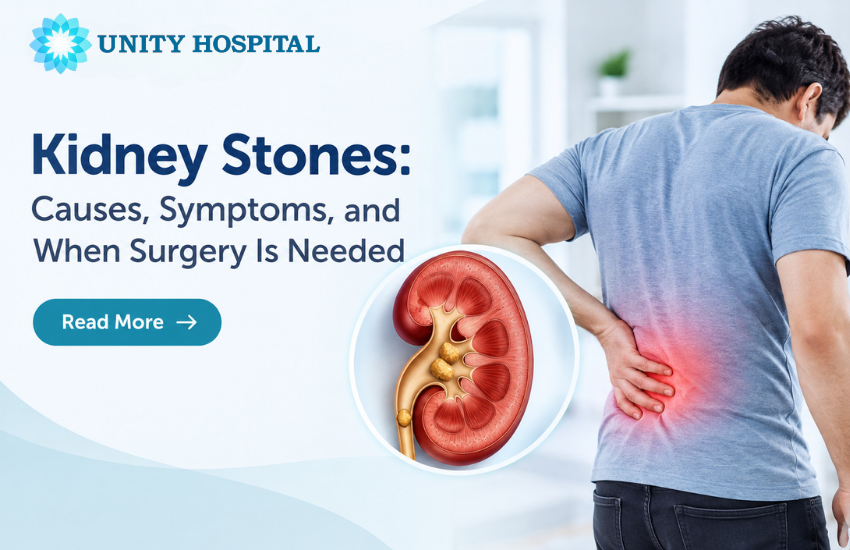 Kidney Stones: Causes, Symptoms, and When Surgery Is Needed
